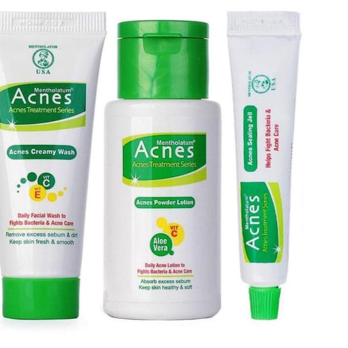 Miliki `ღ´ PHINKL `ღ´ a̳c̳n̳e̳s̳ Acnes Starter 3 In 1 Pack trial kit untuk jerawat