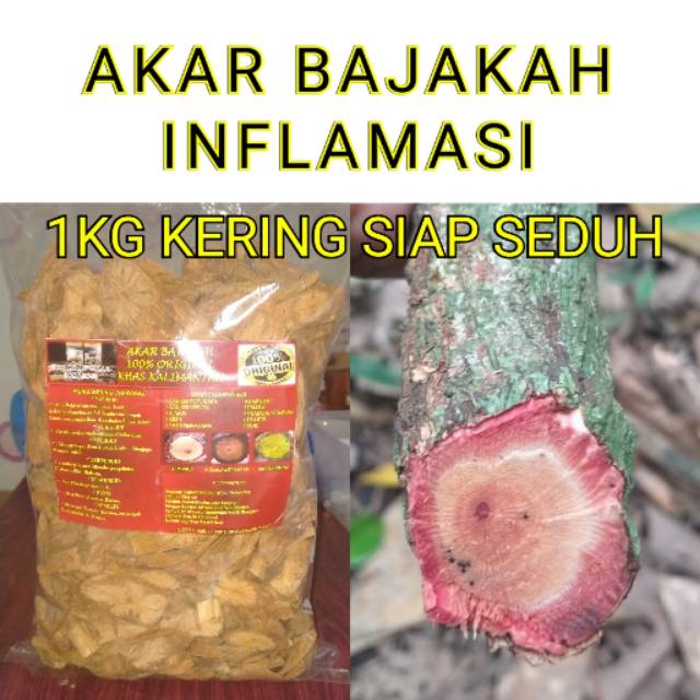 

AKAR BAJAKAH INFLAMASI 1KG KERING SIAP SEDUH