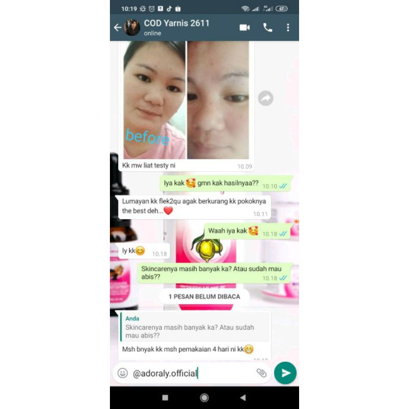 ADORALY SKINCARE ORIGINAL - SKINCARE GLOWING JAKARTA FREE HADIAH-5
