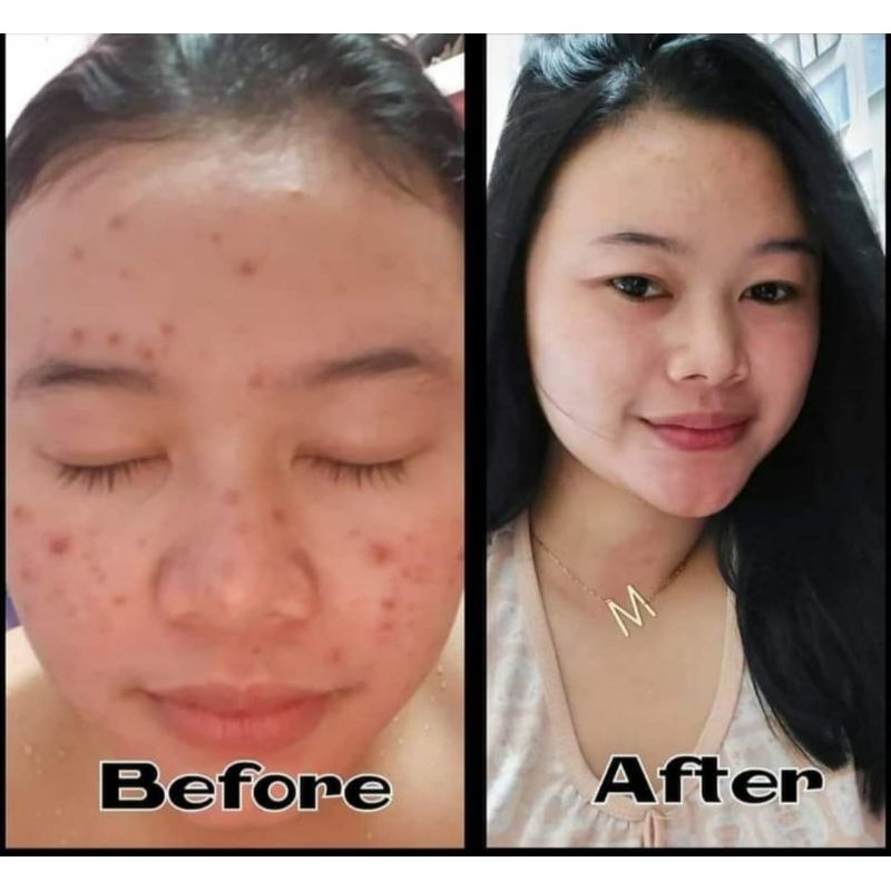 Bisa cod bpom skincare cream paket lengkap syahreni glowing set krim siang malam ori syahraeni syr-3
