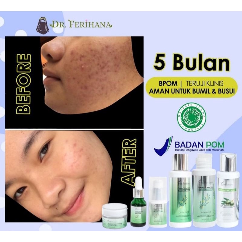 FREE GIFT | PAKET GALACTOMYCES FOR OILY TO ACNE DR. FERIHANA COSMETICS | SARASDRFERIHANACOSMETICS