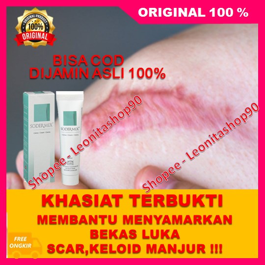 Sodermix Cream Menyamarkan Bekas Luka Scar Keloid Ruam Popok Ampuh 100% ORIGINAL