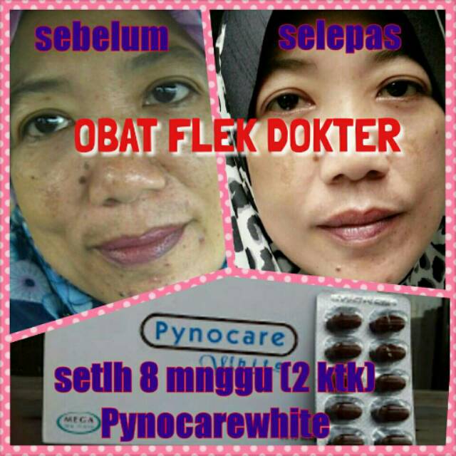 OBAT FLEK DOKTER AMPUH ORIGINAL PYNOCARE WHITE