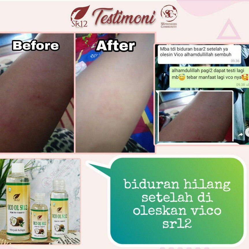 VCO Oil SR12 Minyak Kelapa Murni - Minyak V-CO Untuk Kecantikan - VCO Virgin Coconut Oil SR12 Herbal Tinggi Asam Laurat Untuk ASI Booster, Imun Booster &amp; Daya Tahan Tubuh - VCO Perawatan Rambut , Kulit Pecah Pecah &amp; Kerutan Wajah - VCO Kapsul - VCO Kucing