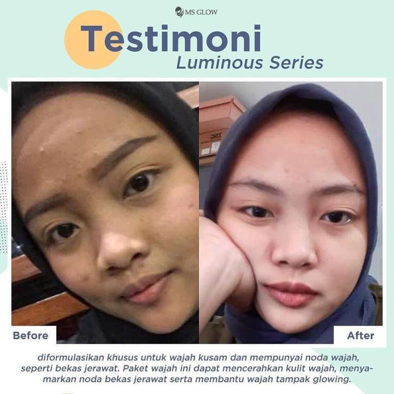 Ms Glow Paket Luminous Skincare Ms Glow Luminous Series Original 100%