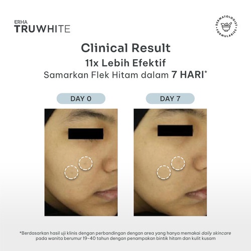 ERHA Truwhite Niacinamide &amp; Peptide Dark Spot Corrector - Krim Flek Hitam