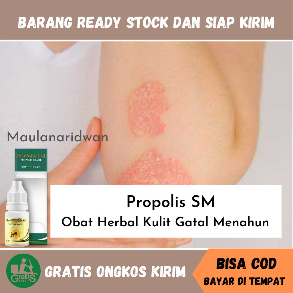Obat Kulit Gatal Menahun, Psoriasis, Gatal Bernanah, Alergi Kulit, Obat Herbal Penghilang Kulit Gata