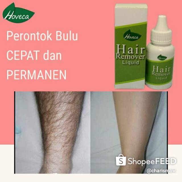 Hoveca Perontok Bulu Kaki, Ketiak, Kumis dan MissV AMAN