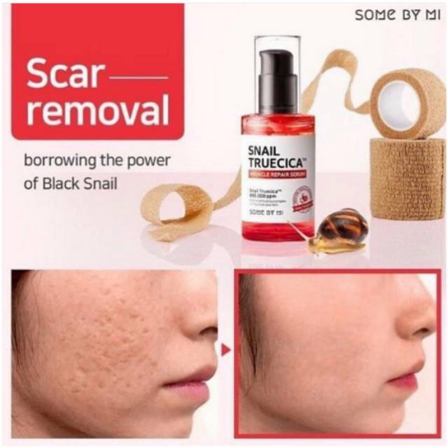 Somebymi snail truecica miracle repair serum 50ml