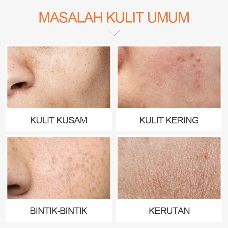 LAIKOU Vitamin C Serum Wajah Memutihkan Menghilangkan Flek Anti-oksidan 30ml