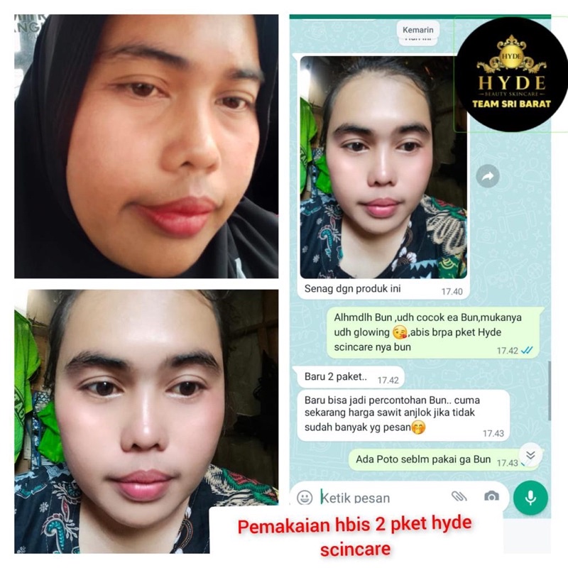 Serum Glowing Bunga Sakura Hyde Beauty Skincare