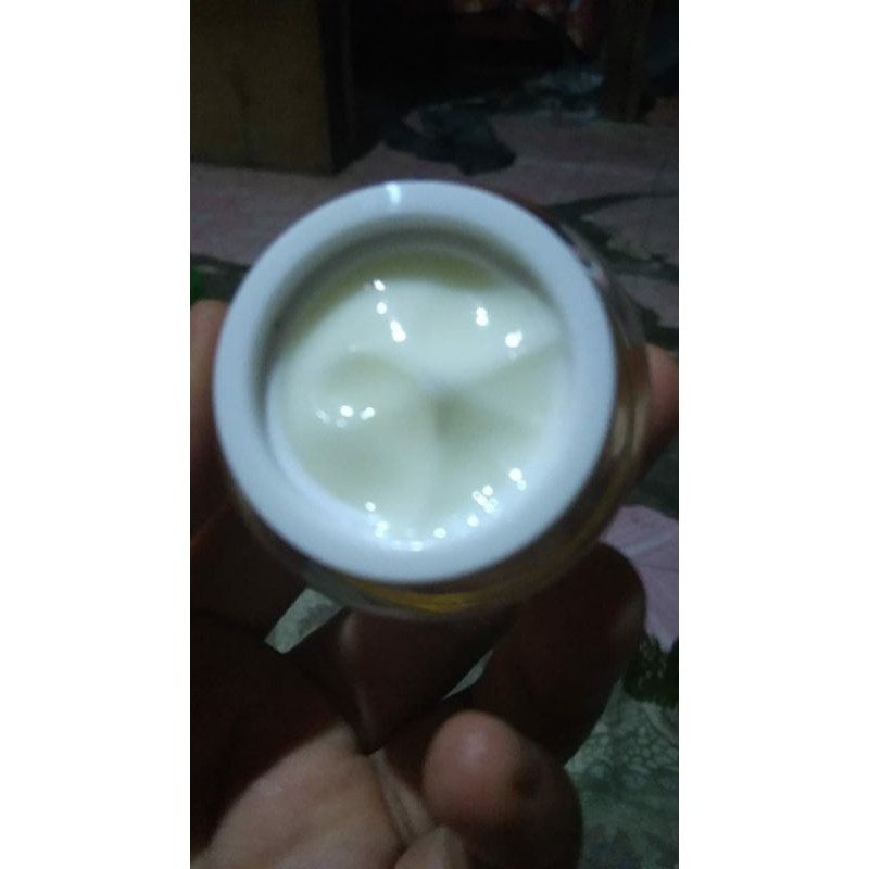 Krim iritasi kulit anzora