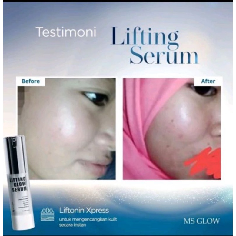 Serum Lifting 15ml +Pore Away MS GLOW