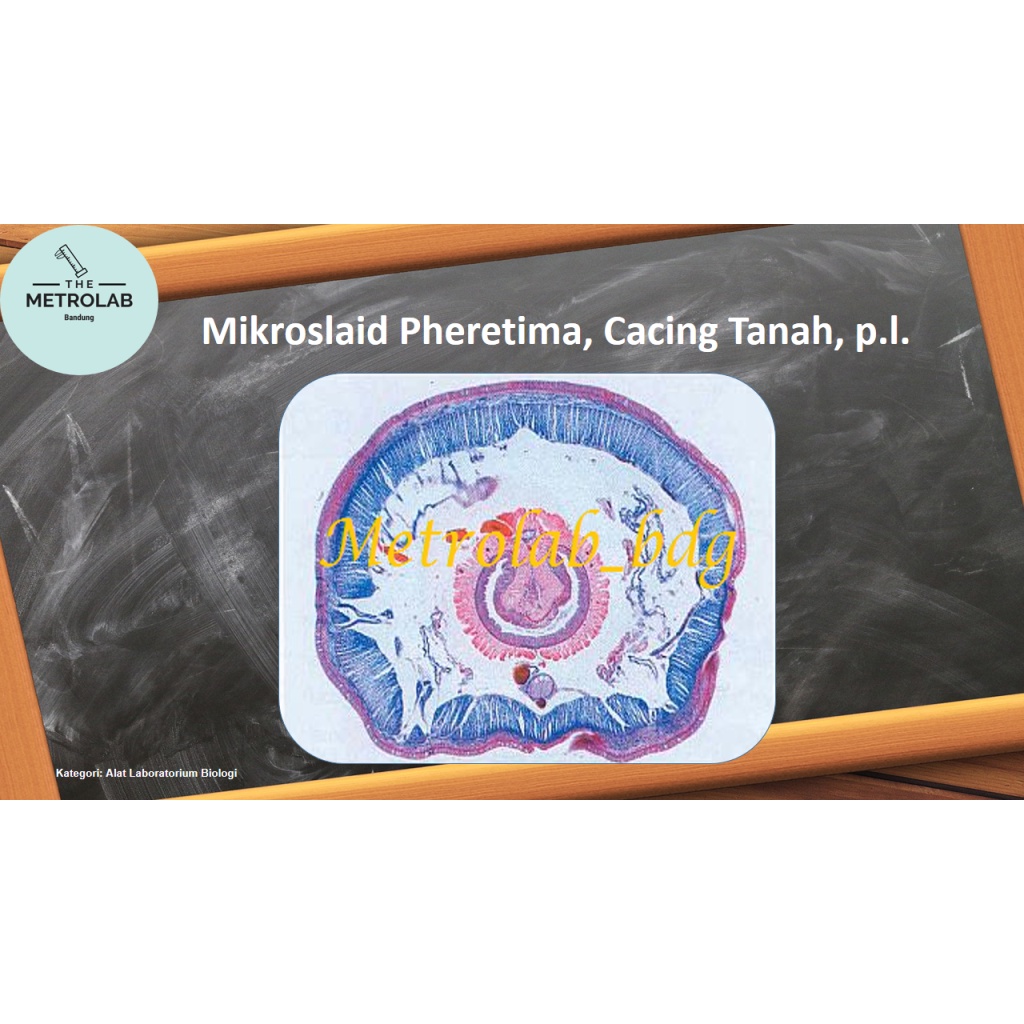 Mikroslaid | Preparat Kering | Pheretima, Cacing Tanah, p.l.
