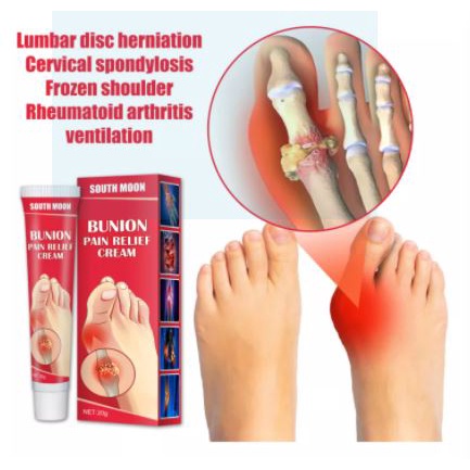 Salep Bunion Pain Relief Cream Splint Jari Kaki Hallux Valgus Pengobatan Arthritis Lutut, Pereda Nyeri Pada Sendi