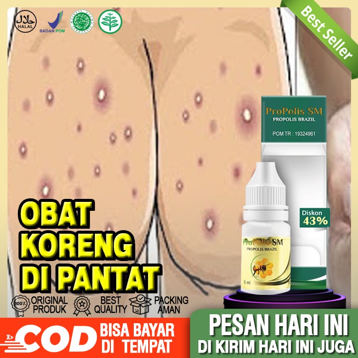 Obat Koreng Di Pantat, Bekas Luka Hitam Di Pantat, Menghilangkan Koreng Di Pantat, Penghilang Koreng