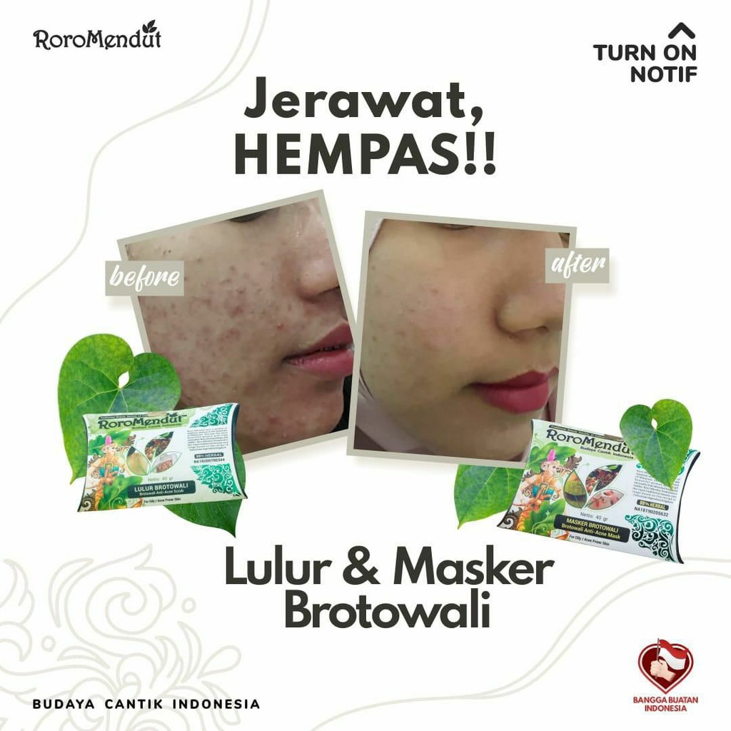 Roro Mendut Masker Brotowali Anti Acne / Jerawat / Komedo Organik / Herbal 20gr &amp; 40gr