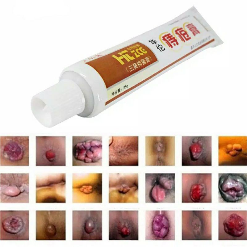 Original Wasir Obat Huatuo Salep Cream Ambeyen Ambeien Asli 100 Herbal Aman Shopee Indonesia