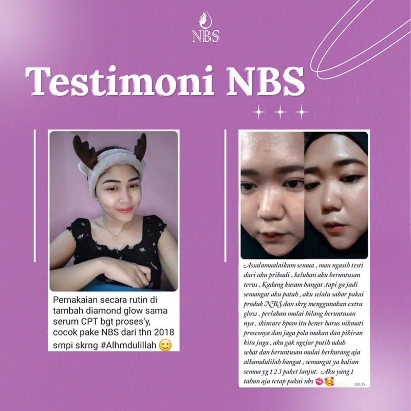 N B S EXTRA GLOW N B S ULTIMATE PEMUTIH WAJAH PENGHILANG FLEK JERAWAT ORIGINAL NONI BEAUTY SKINCARE