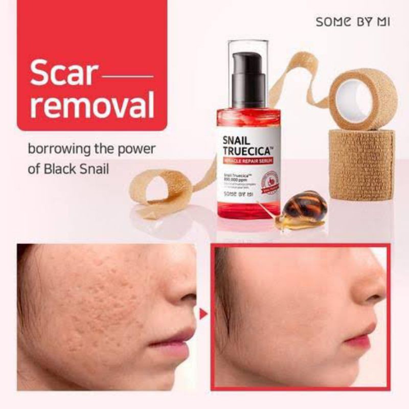 SOMEBYMI Snail Truecica Miracle Serum
