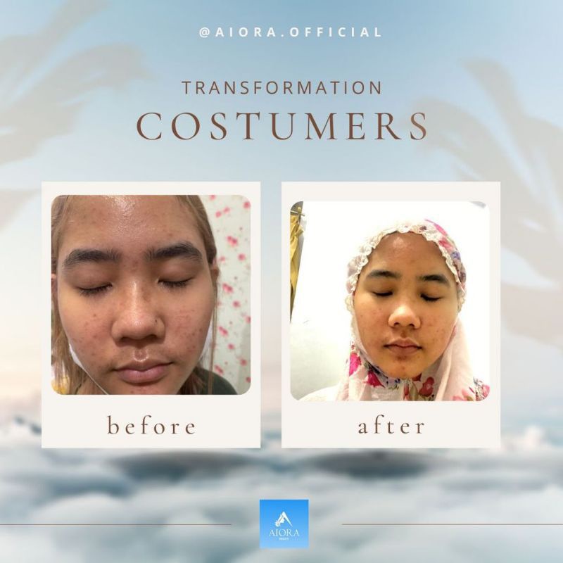AIORA BEAUTE ORI 100% FREE GIFT-4