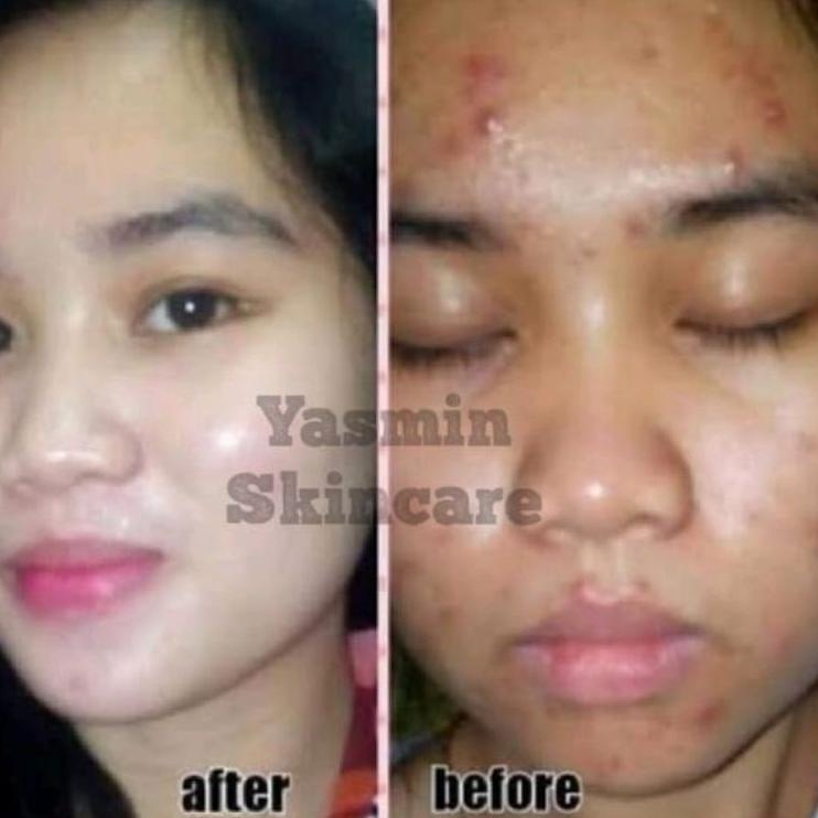 ☻ [COD] Paket cream farma / farma  wdc spc 5% 10% Original 3in1 / 4in1 paket glowing Skincare Origin