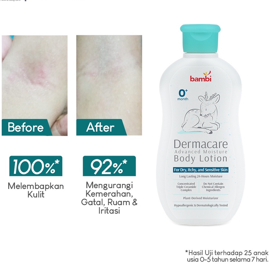 Bambi Baby Dermacare Daily Soothing &amp; Calming Theraphy Head To Toe Wash 200ml / Advanced Moisture Body Lotion 200ml /Powder Compact Dermacare 40gr