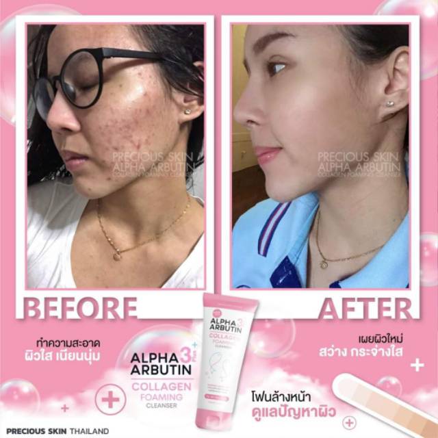 BPOM ALPHA ARBUTIN 3+++ COLLAGEN FOAMING FACE CLEANSER / SABUN MUKA / SABUN WAJAH / FOAMING WAJAH