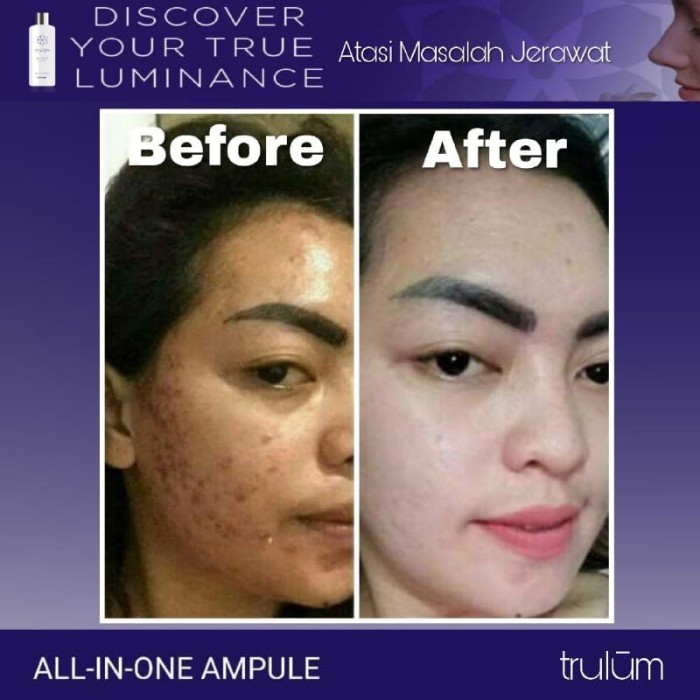 Serum/Obat/Cream/Krim Solusi Terbaik Penghilang Keriput Pada Wajah