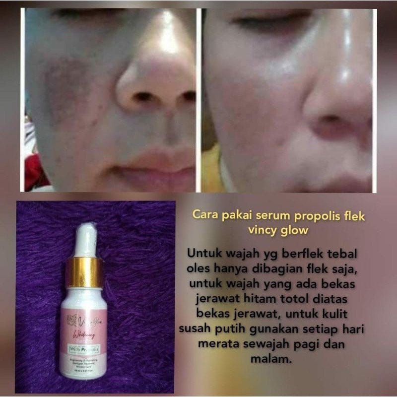 SERUM PROPOLIS .PENGHILANG FLEK MEMBANDEL.MENCERAHKAN.MEMUTIHKAN.MENGHILANGKAN BEKAS JERAWAT .BINTIK