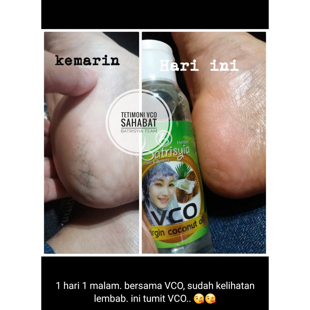 Batrisyia Virgin Coconut Oil Vco Minyak Kelapa Original Kapsul Cair Indonesia