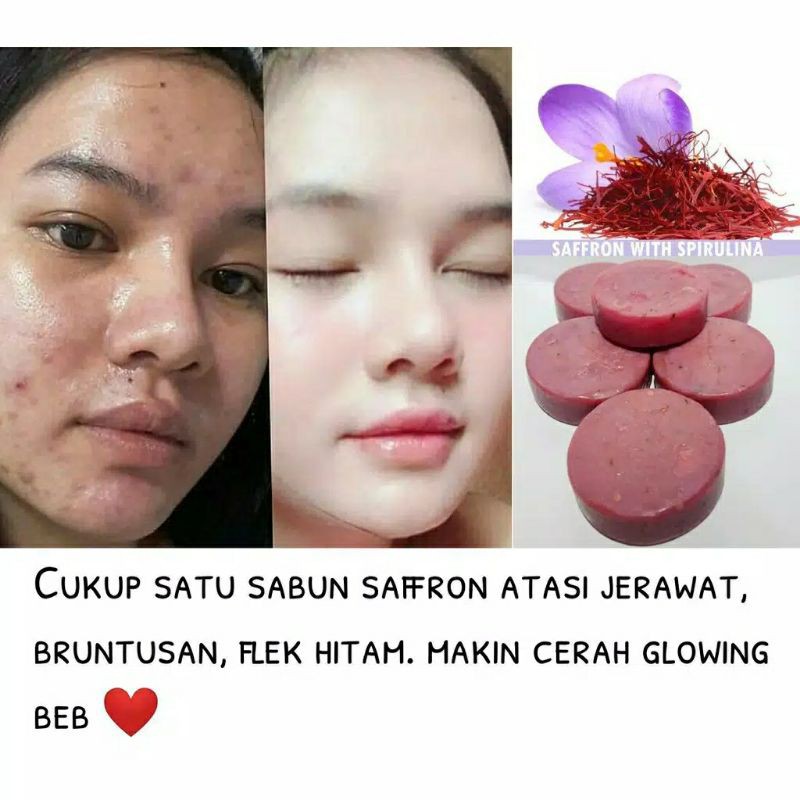 PROMO !! Sabun Safron Pemutih Wajah dan Penghilang Flek Hitam dan Jerawat Ampuh