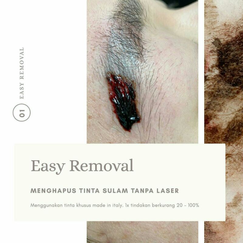 KURSUS EASY REMOVAL