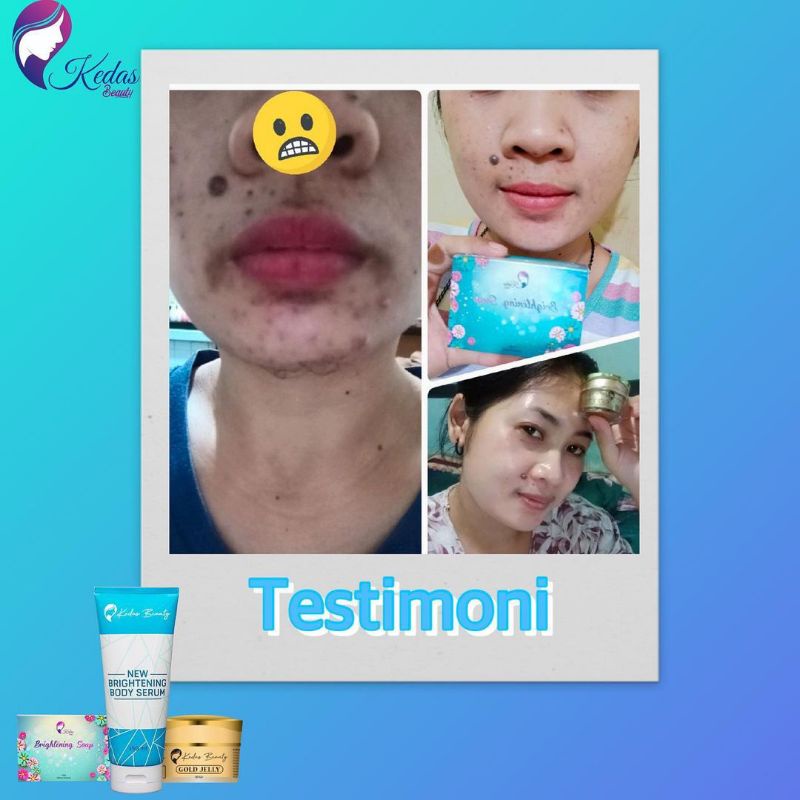 GOLD JELLY KEDAS BEAUTY KEMASAN BARU 100% original RESELLER RESMI-2