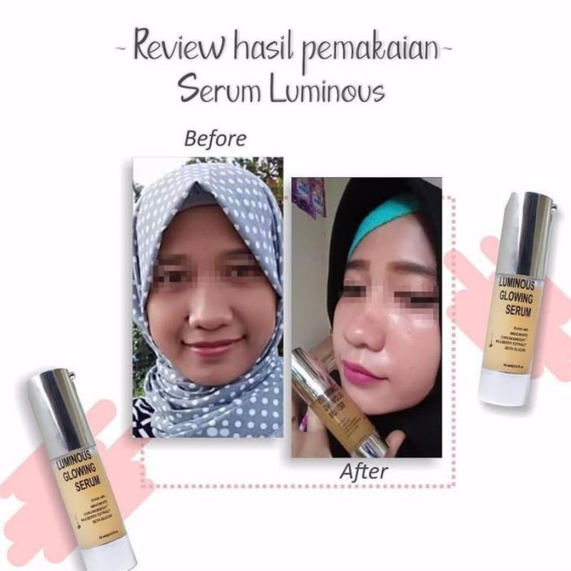 SERUM MS GLOW/SERUM LUMINOS/SERUM WHITENING GOLD/SERUM ACNE