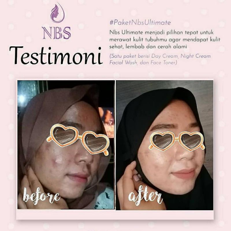 NBS SKINCARE ULTIMATE NEW-4