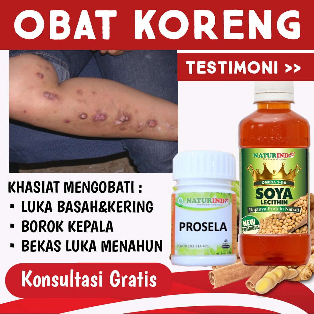 Jual OBAT KORENG OBAT BOROK KAKI OBAT KORENG KAKI KULIT MENGHITAM