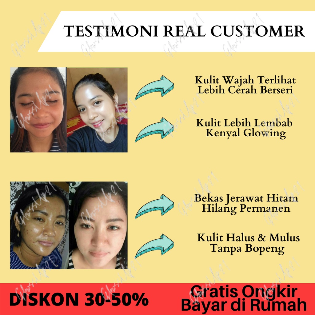 SERUM PENCERAH WAJAH PENGHILANG BEKAS JERAWAT DR PURE SERUM WHITENING BPOM ORIGINAL