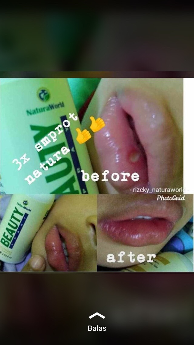 Natura Beauty Spray Original Asli(free Masker Kain 3lapis)