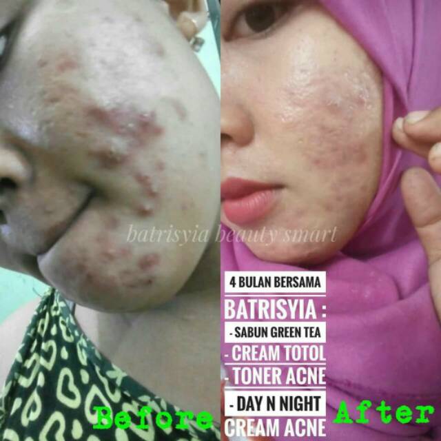 Cream Exclusive Oily Batrisyia eksklusif oil Pelembab Wajah untuk kulit berminyak kusam berjerawat