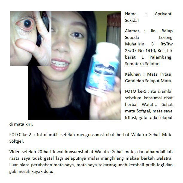 Obat Mata Berlemak Silinder Buram Berair Limatta 30 Softgel Bpom