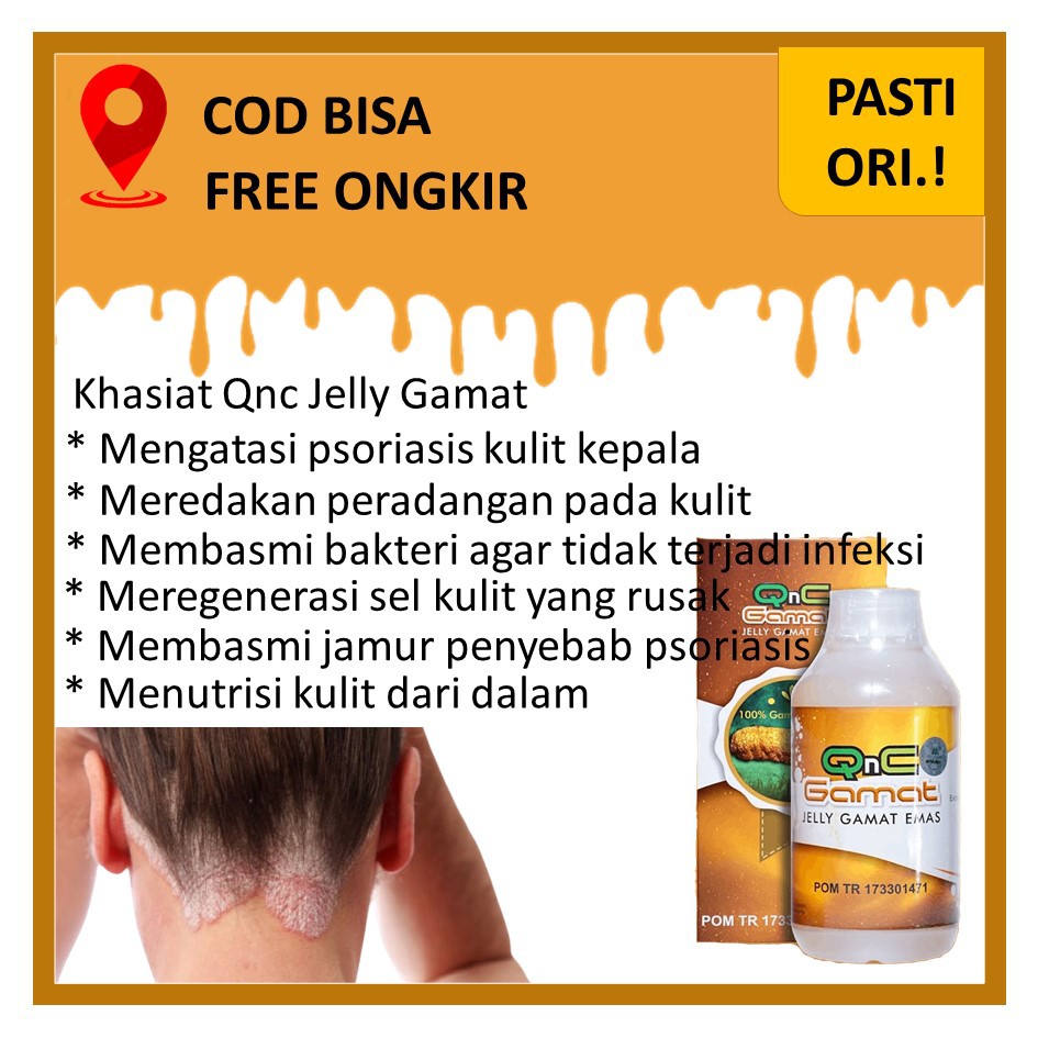 Obat Psoriasis Kulit Kepala Qnc Jelly Gamat 100 Original Indonesia