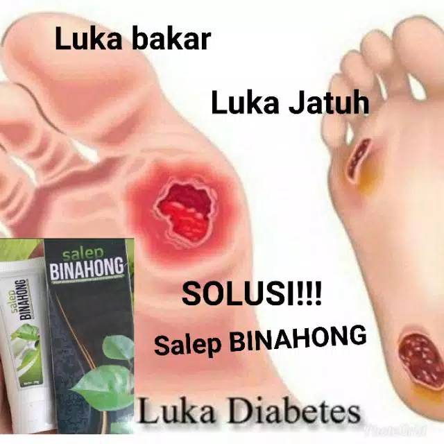Salep binahong untuk luka, luka diabetes, gatal-gatal, jerawat, wasir/ambeyen