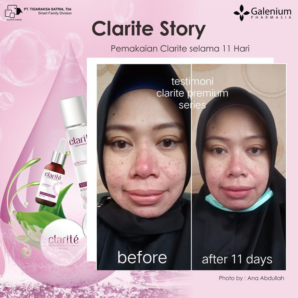 CLARITE PREMIUM SKINCARE AMAN UNTUK IBU HAMIL DAN BUSUI