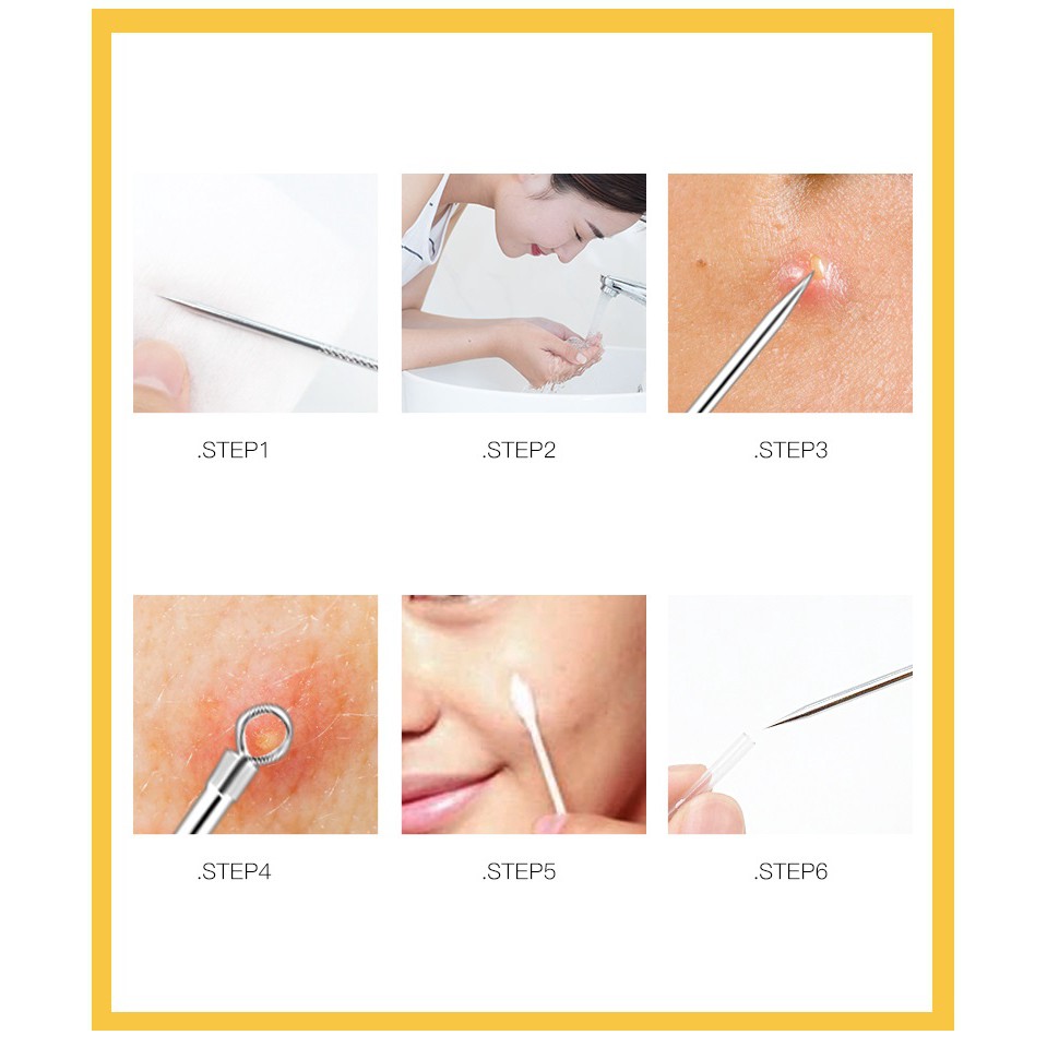 ELFYDO HL0140 Alat Pencet Jerawat Komedo Set 4 In 1 Pinset Jerawat Pembersih Blackhead