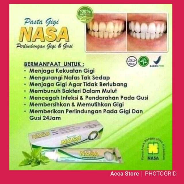 Pasta gigi/pasta gigi nasa/pasta gigi putih