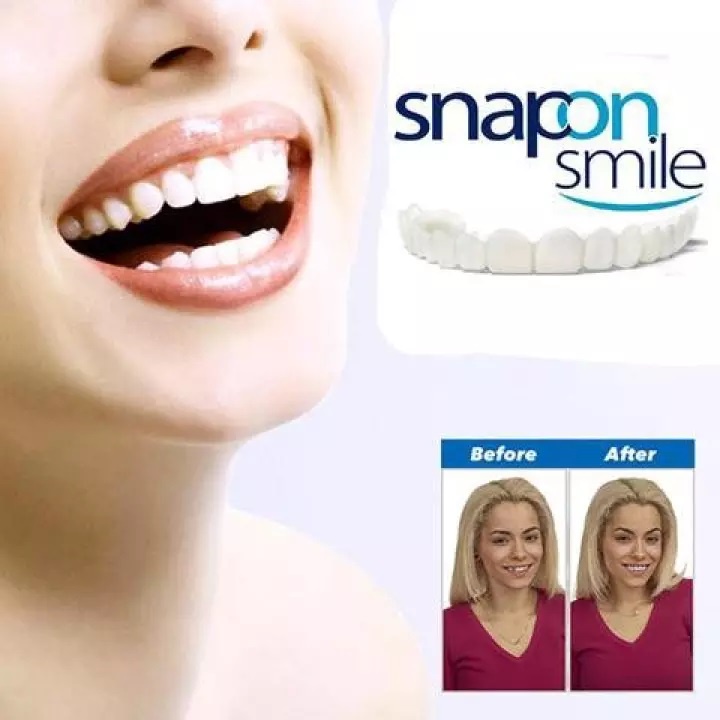 DBI - SNAP ON SMILE SEPASANG GIGI PALSU SILICON 1 SET ATAS BAWAH