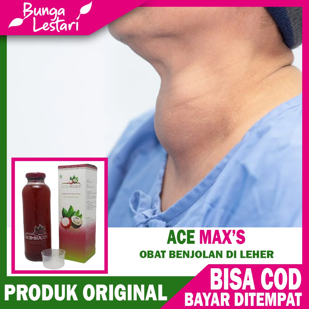 

(BISA COD) Obat Benjolan di Leher, Kelenjar Getah Bening, Tbc Kelenjar, Tiroid Herbal yang Ampuh !