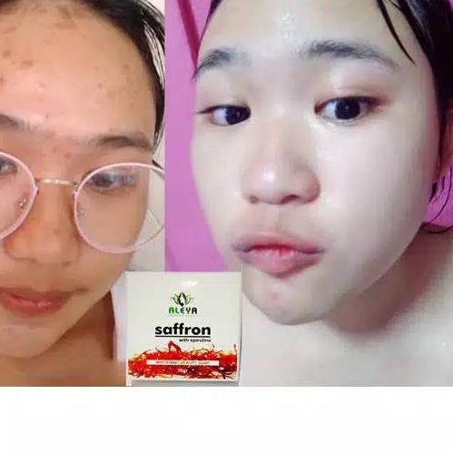 ♡ Sabun safron aleya with spirulina sabun jerawat ❇