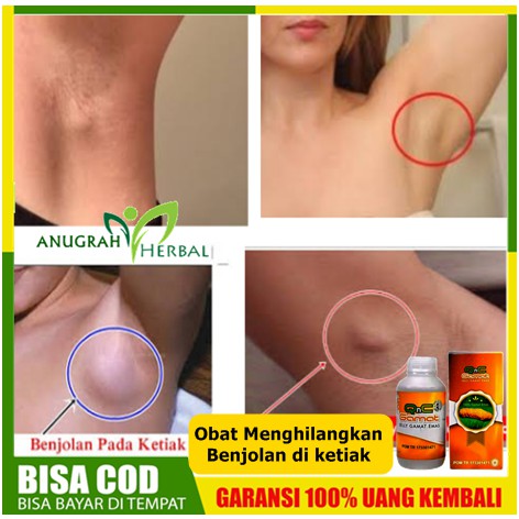 Obat Menghilangkan Benjolan Di Ketiak Penghilang Benjolan Di Ketiak Sebelah Kiri Kanan Gamat Shopee Indonesia